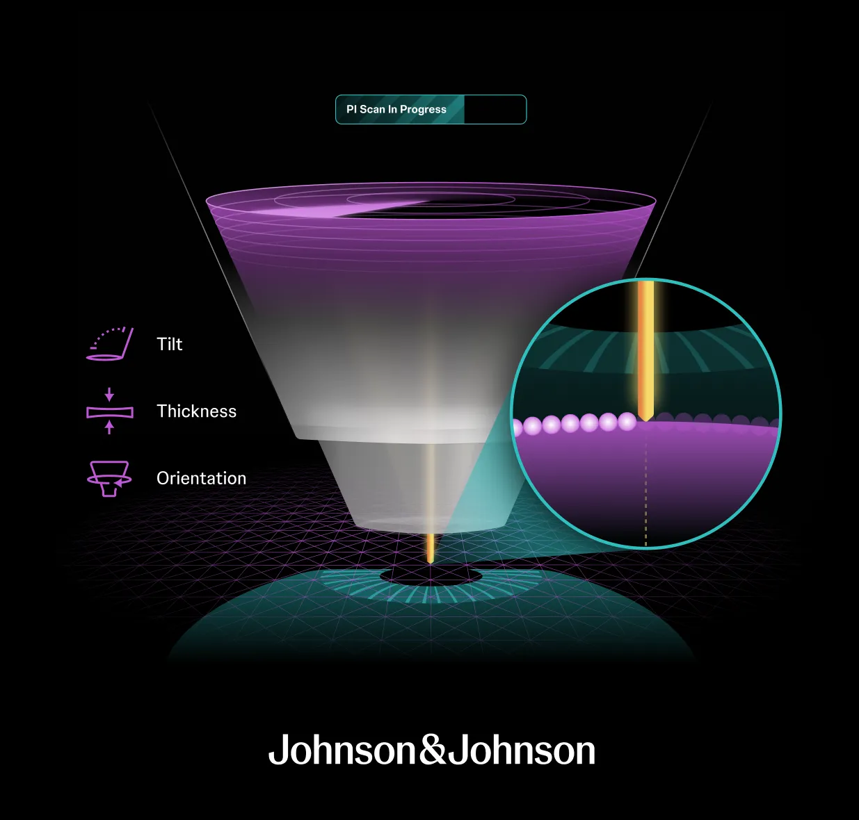 Johnson & Johnson PI Scan Graphic