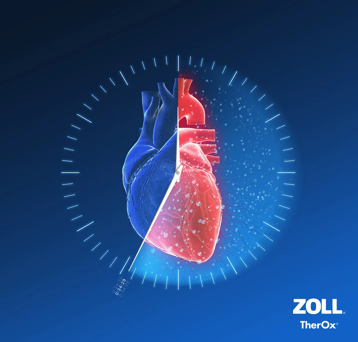Zoll heart/timer graphic